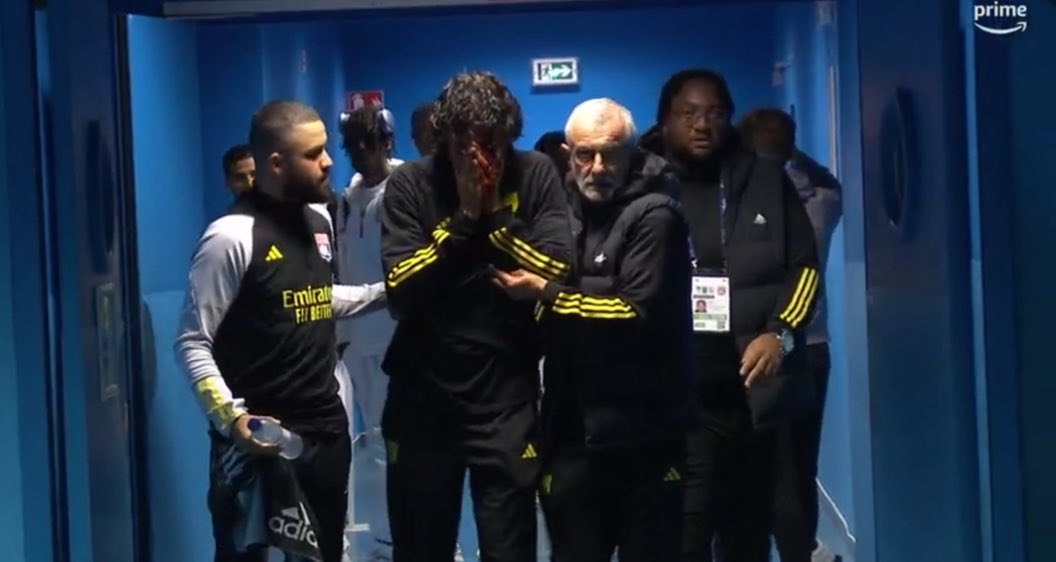 Hinchas de Marsella apedrearon bus de Lyon e hirieron a Fabio Grosso
