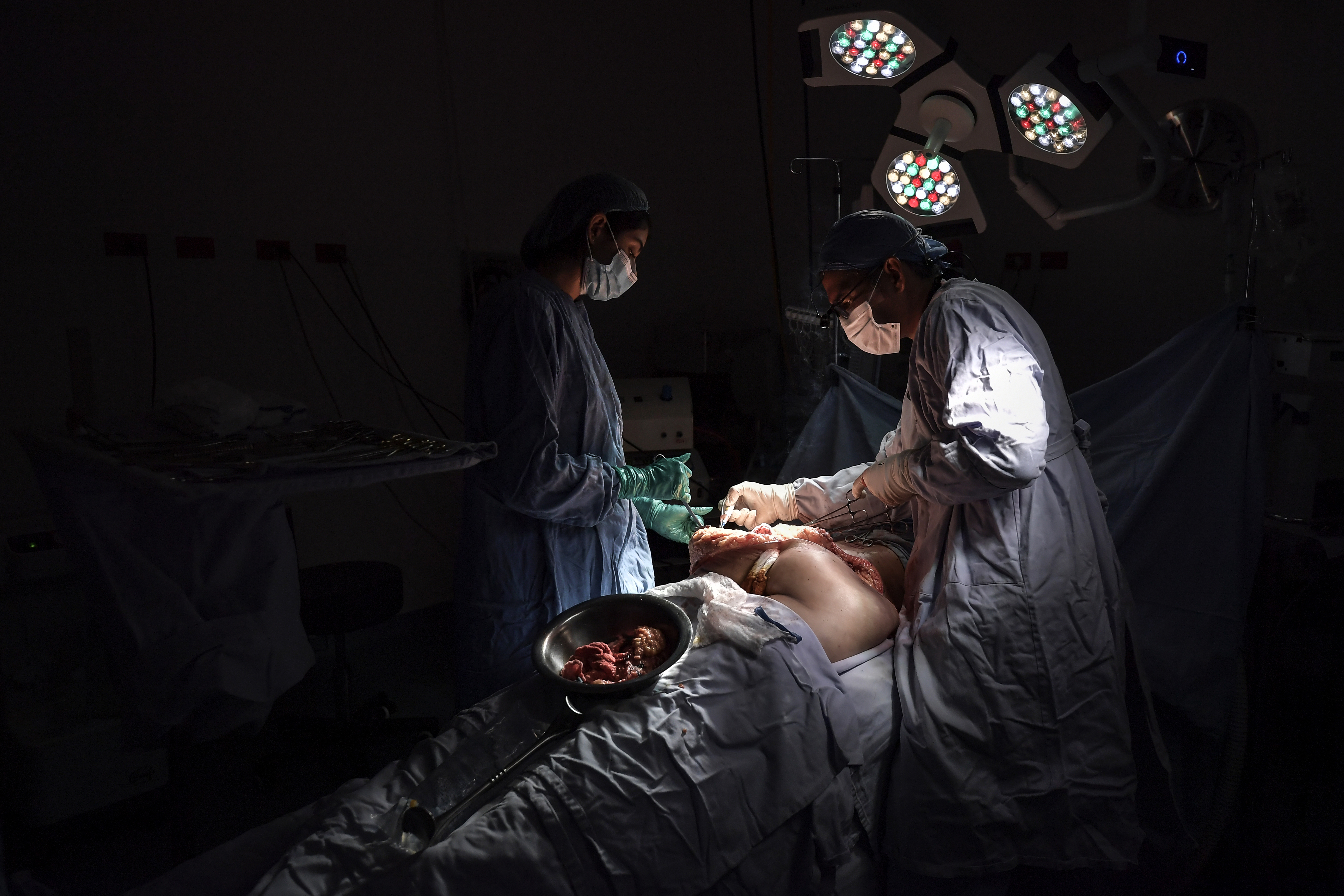 Mujeres trans, víctimas de biopolímeros, un problema de salud pública sin cifras