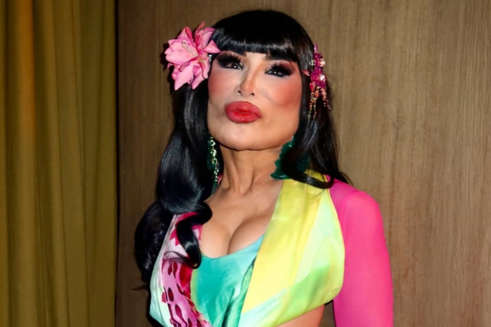 Lyn May contó la verdad de la transformación de su rostro: “Terrible”. Así se veía antes