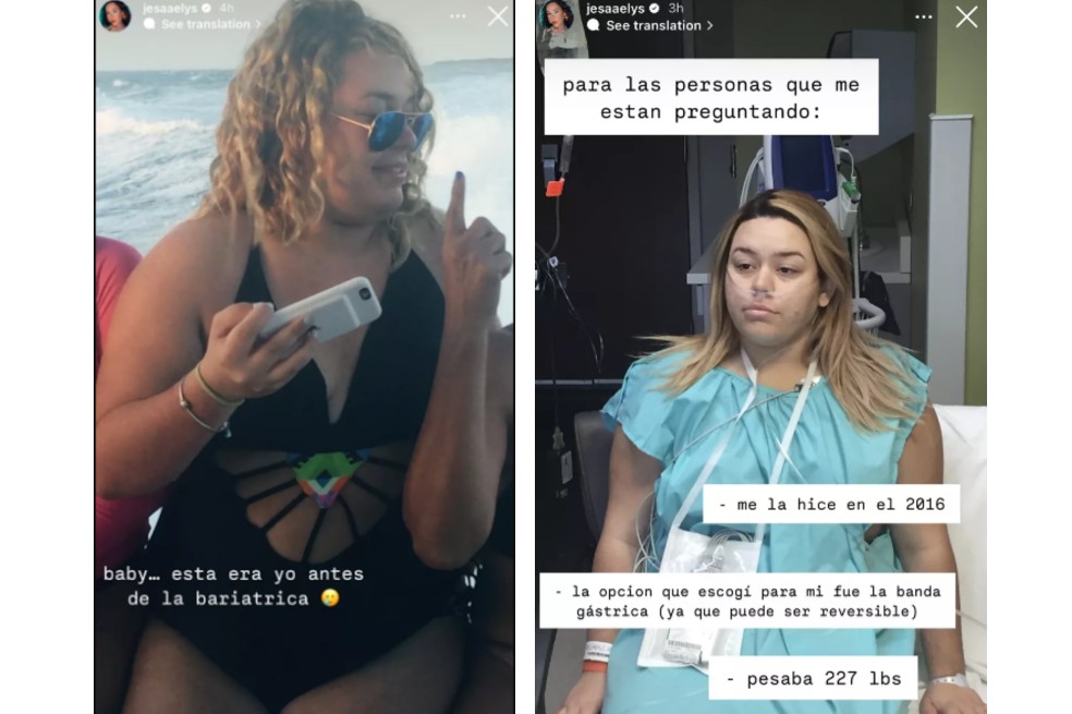 “Pesaba 227 libras”, recordó Jessaelys Ayala.