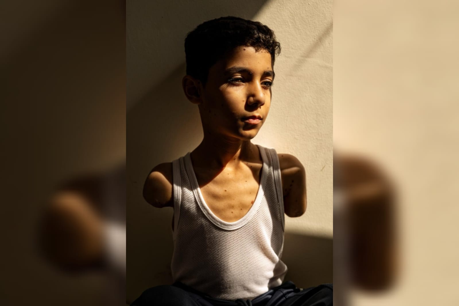 La imagen de un niño mutilado en Gaza gana el premio a Foto del Año