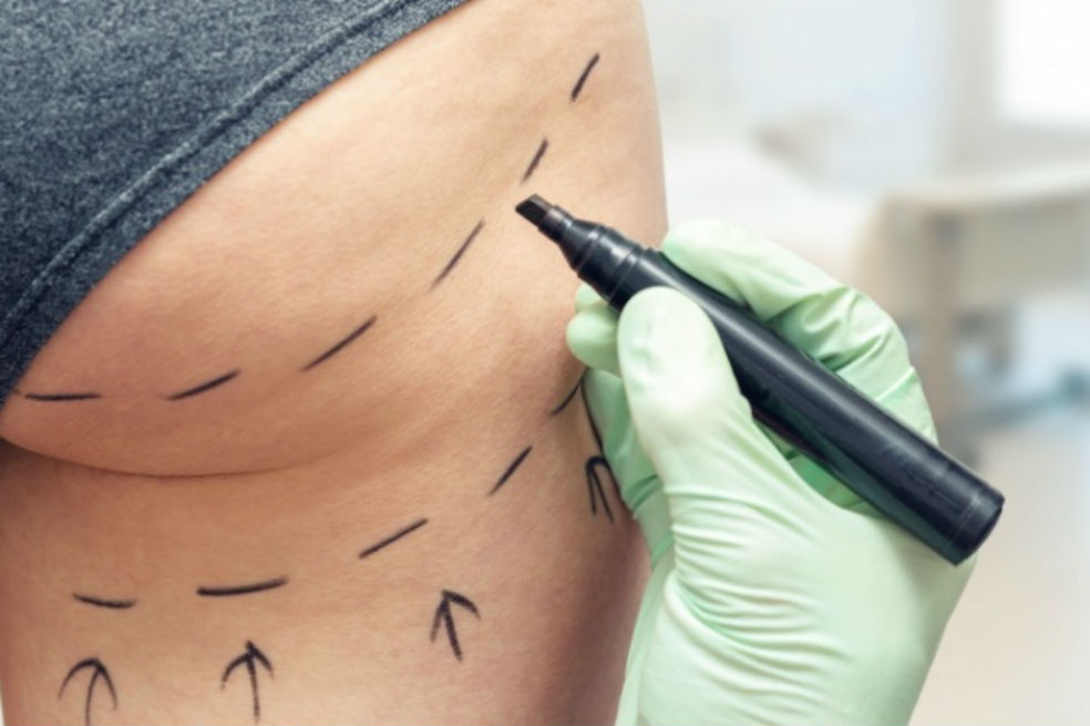 Ya hay una ley que prohíbe el uso de los biopolímeros, ¿cuáles son sus riesgos?