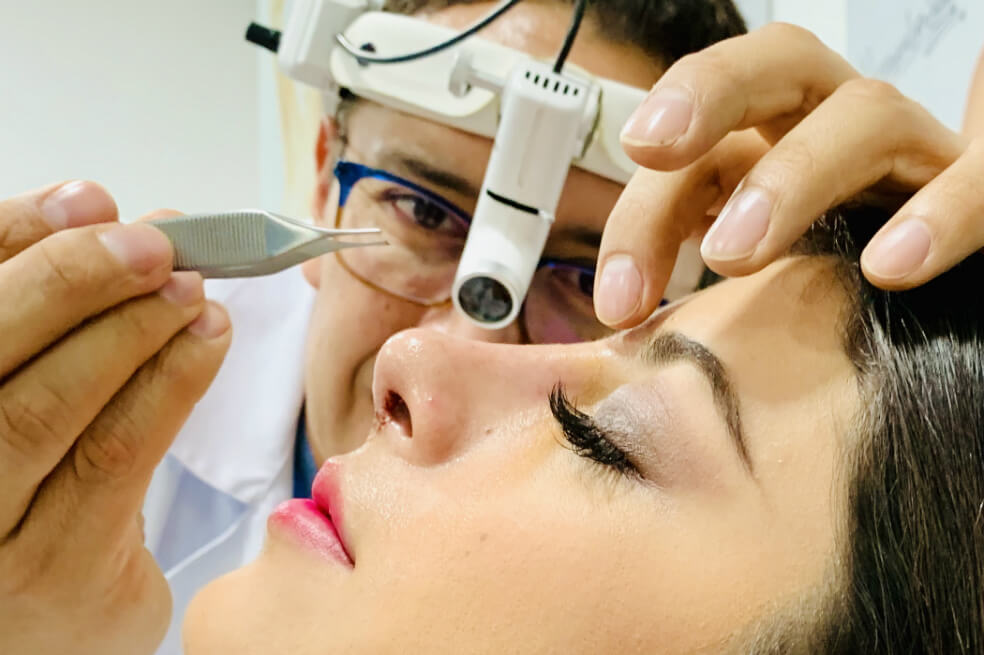 El doctor Mauricio Suárez es el primer cirujano en Colombia en realizar Rinoplastia Ultrasónica