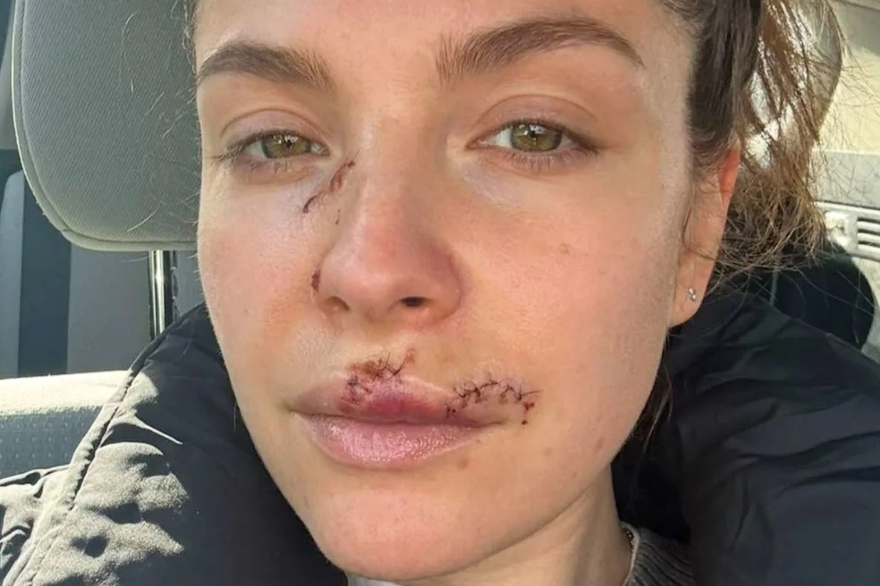 A través de sus historias de Instagram, Paige Spara compartió una foto reciente de su proceso de recuperación.