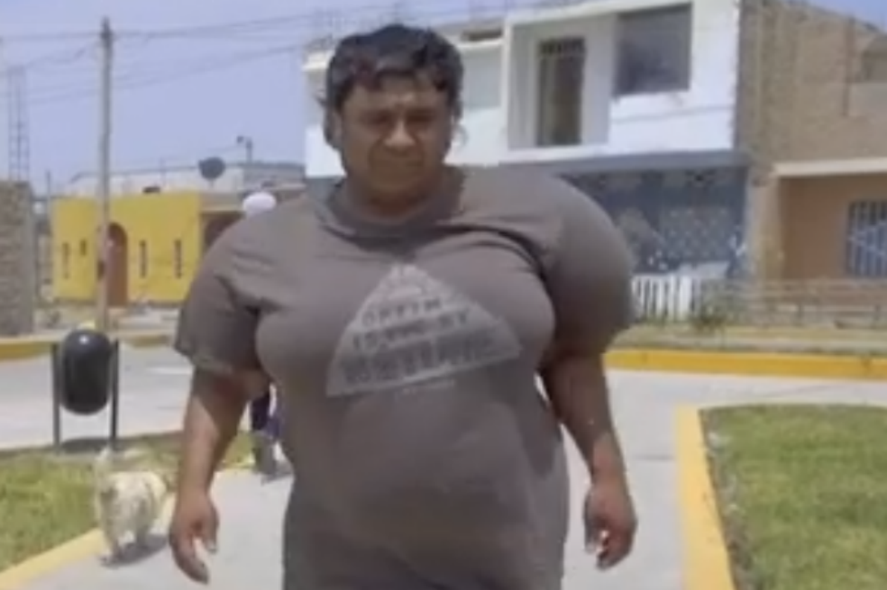 Desde hace cuatro años, a un buzo peruano se le deformó el cuerpo