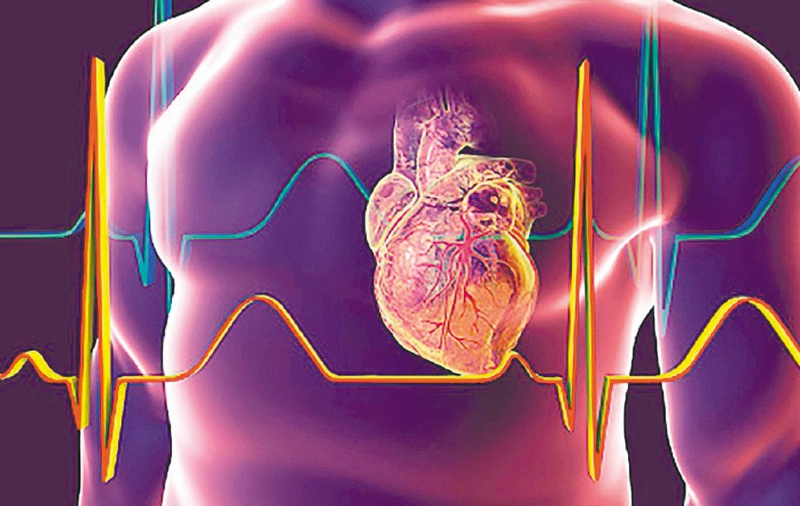 Enfermedades cardiovasculares: ¿Por qué son la principal causa de muerte?