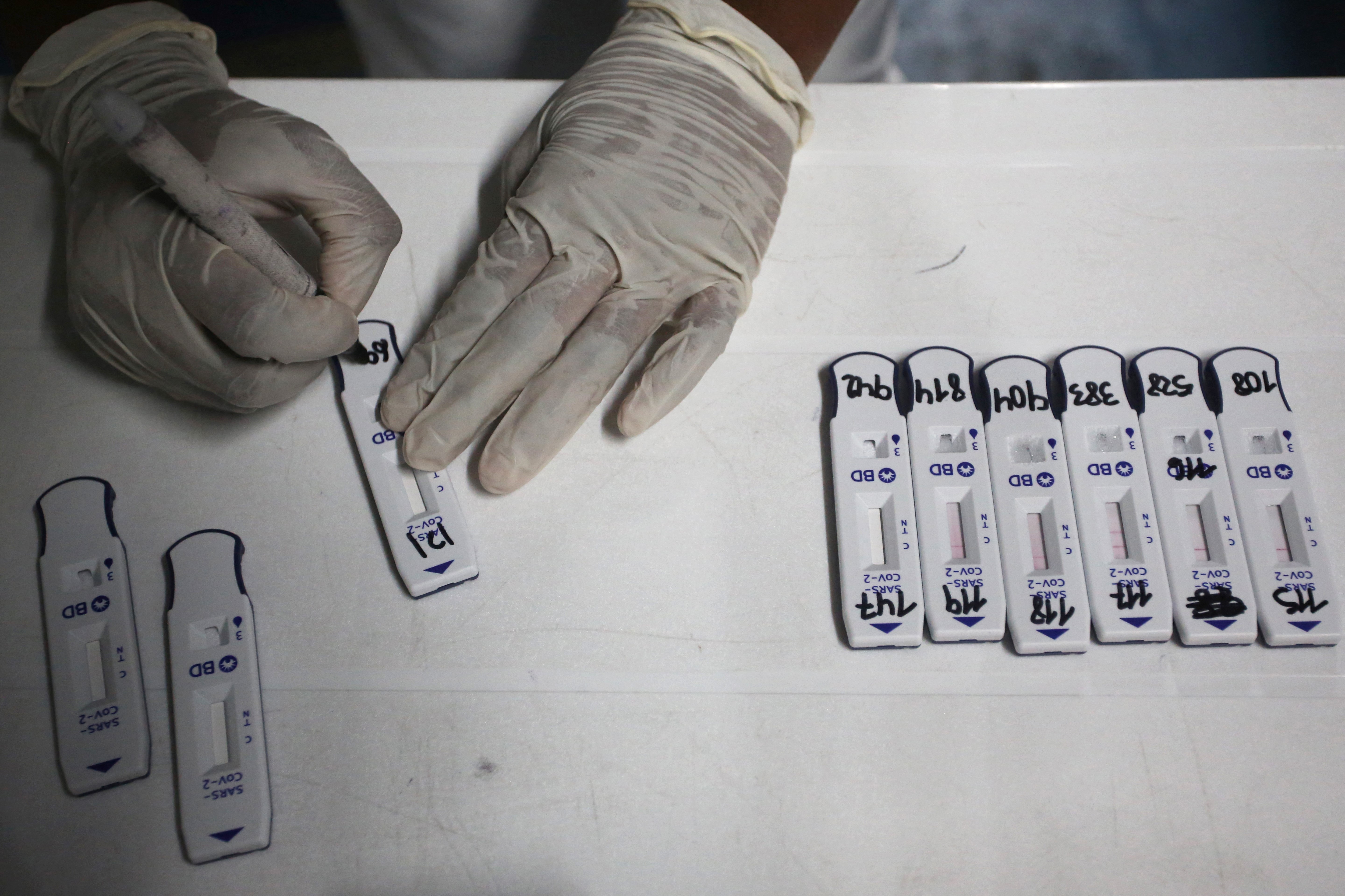 Pese a aumento de casos global por ómicron, las muertes por covid siguen bajando