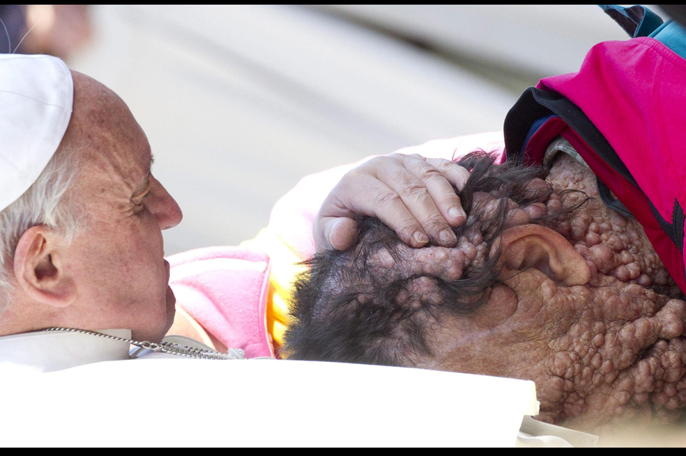 El tierno abrazo del Papa a un hombre visiblemente enfermo