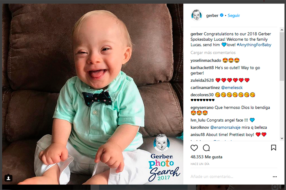 El primer bebé con síndrome de down que protagoniza campaña de compotas