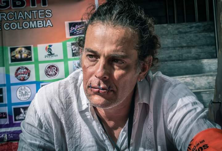 En fotos: Jhon Fitzgerald, el artista que se cosió la boca para protestar en Bogotá