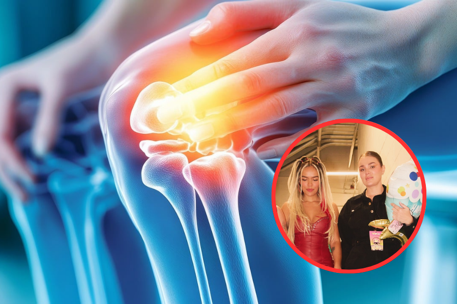 ¿Qué provoca la artritis reactiva? La enfermedad la padece hermana de Karol G