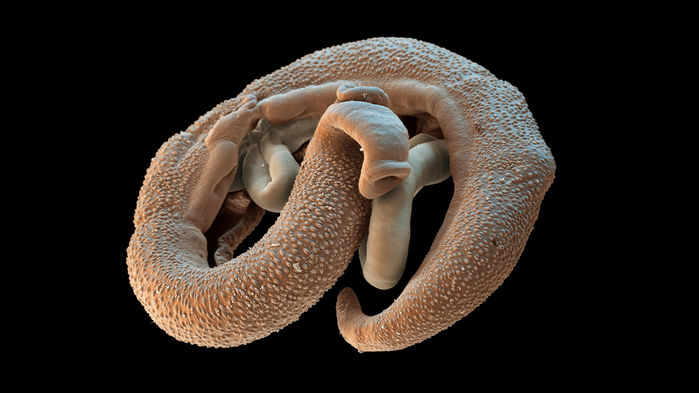 ¿Dejaría que una lombriz viviera dentro de su cuerpo, por la ciencia?