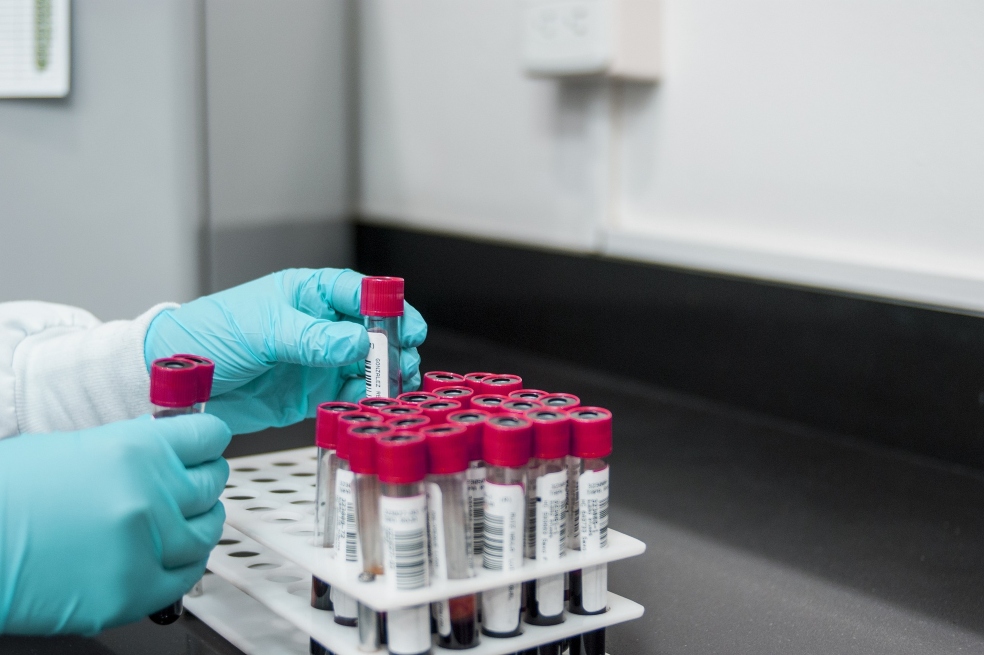 Su grupo sanguíneo puede influir en el riesgo de sufrir un ataque cerebral temprano