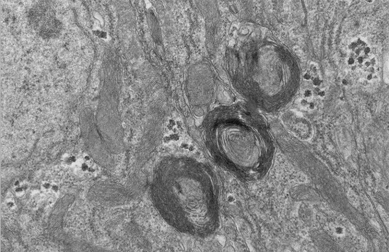 Descubren nuevo “orgánulo” celular en el intestino de un tipo de mosca