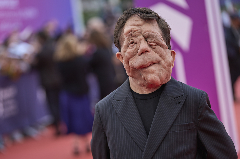 Adam Pearson: qué le pasó, por qué se le desfiguró el rostro y más del actor