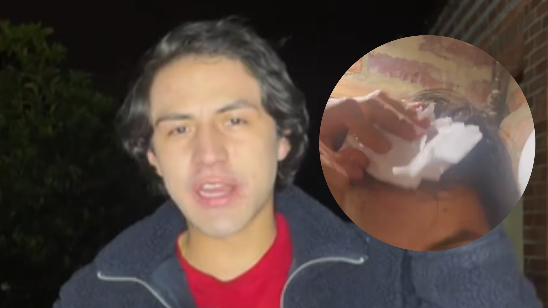 Influencer denunció a Andrés Carne de Res tras caerle un ladrillo en la cabeza