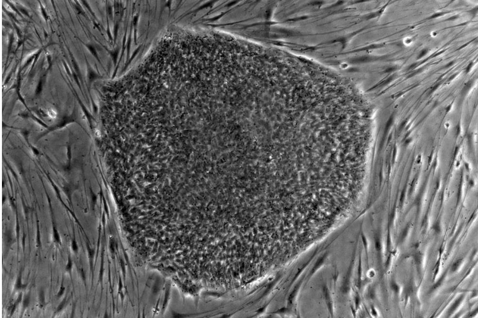 Una celula madre. Investigaciones anteriores demostraron que es posible crear óvulos de ratón usando células madre de la cola de ratones hembras y fertilizarlas con esperma de ratón. / Wikimedia Commons
