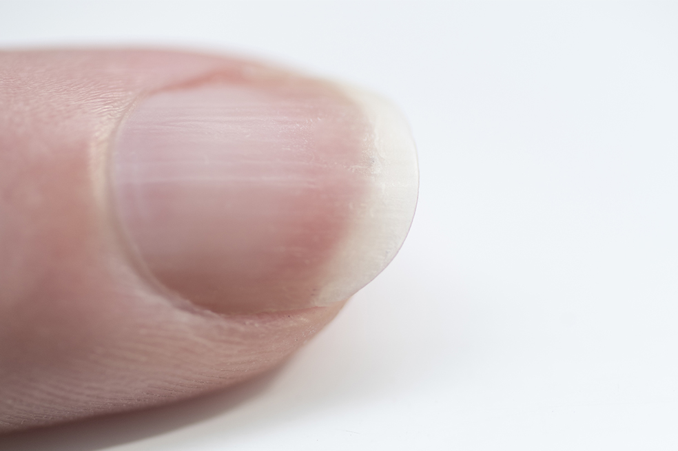 Trucos caseros para no tener las uñas escamadas