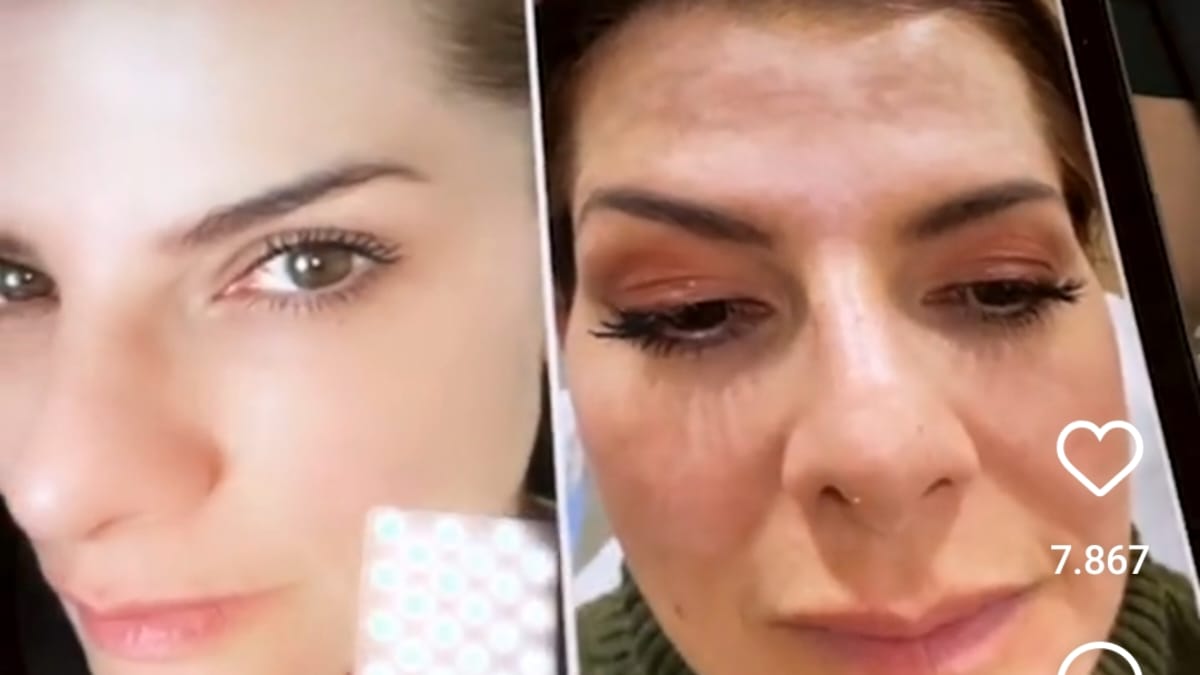 Carolina Cruz antes y ahora: así ha cambiado gracias a su tratamiento de piel