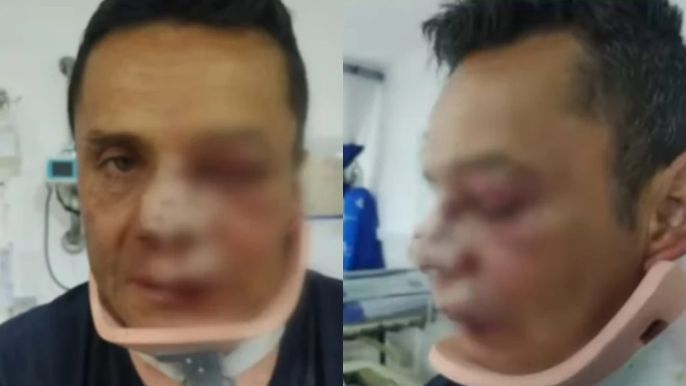 Tras partido América vs. Millonarios, hinchas golpean a un hombre por vestir de azul