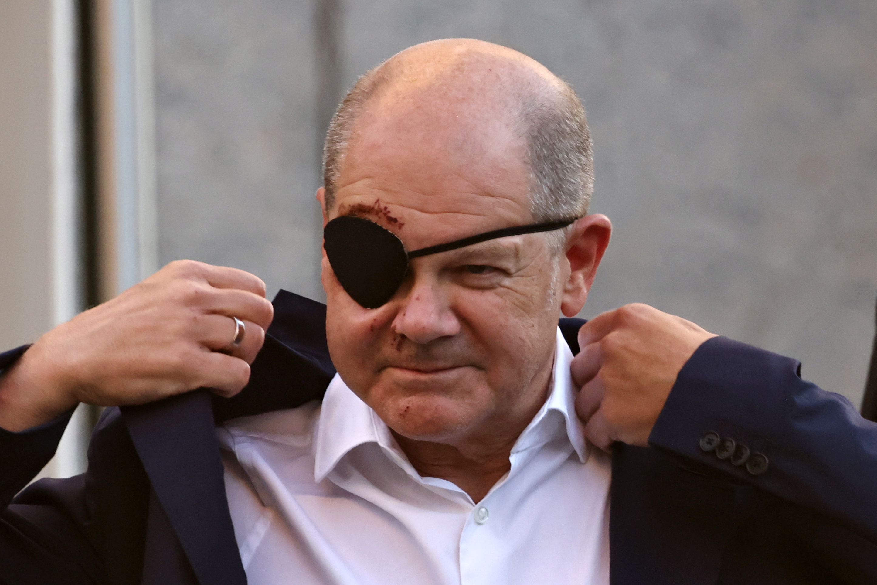 Tras accidente, Olaf Scholz, el canciller alemán, aparece con un parche en el ojo