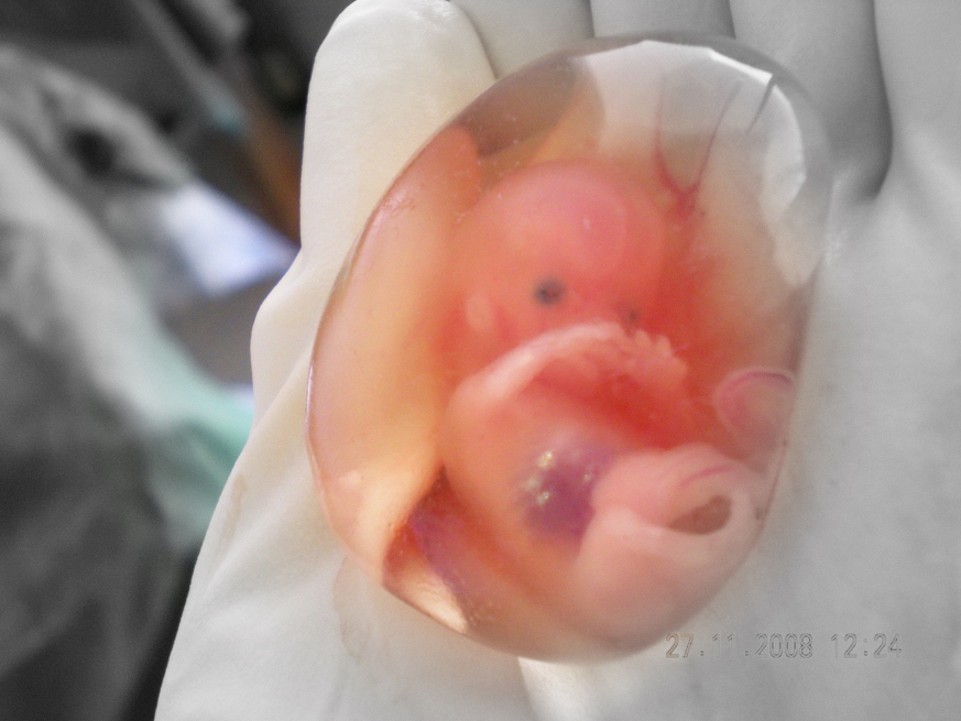 Polución incrementa el riesgo de aborto espontáneo