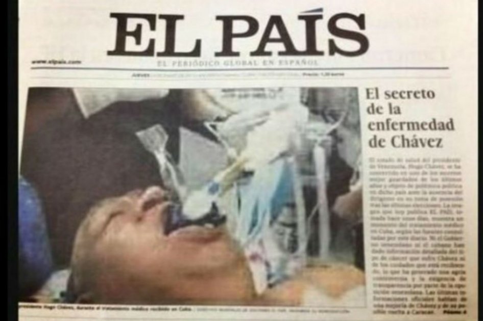 Foto que publicó diario español de Hugo Chávez intubado es falsa