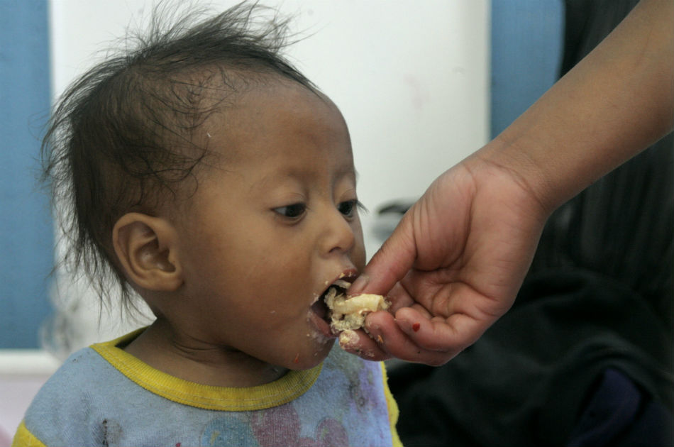 50 niños han muerto por desnutrición en Guatemala en 2013