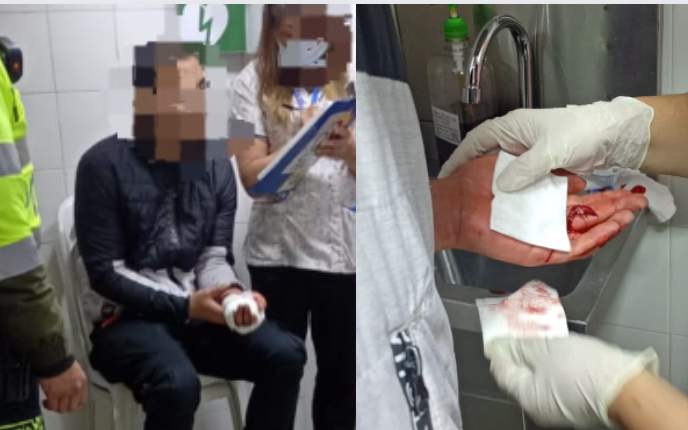 Intentó colarse y salió mal: se lastimó la mano al tratar de evadir el pago de TM
