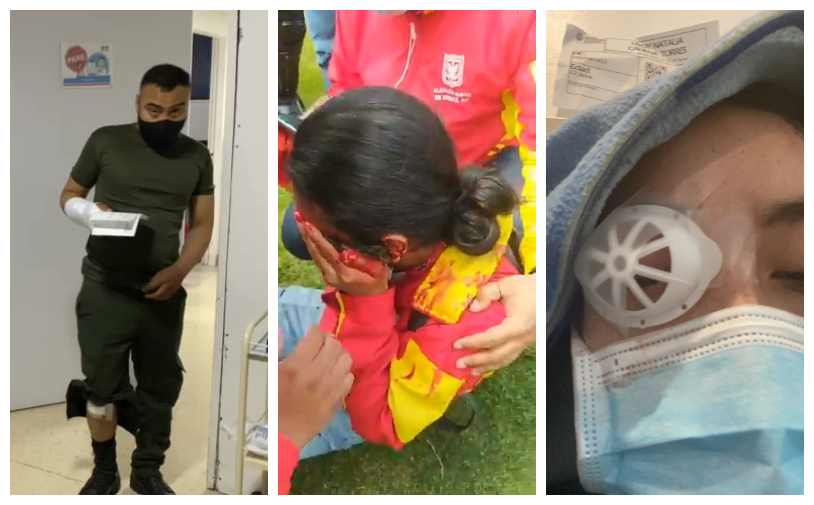 Paro Nacional 28A: Así fue la violencia denunciada por los manifestantes y la Policía