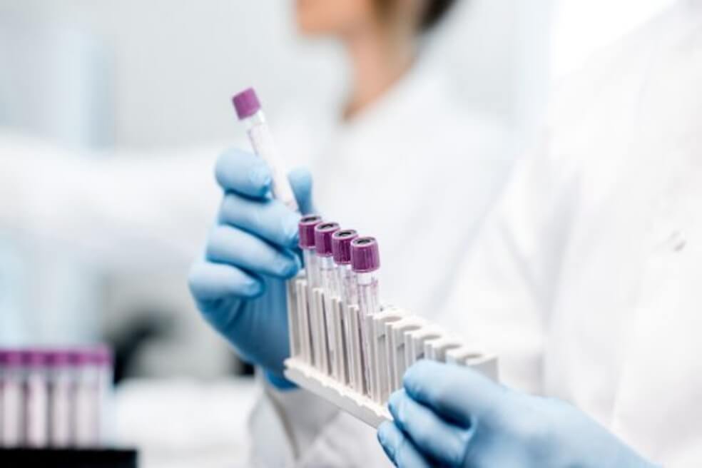 Así se agilizarán las pruebas para detectar coronavirus en Colombia