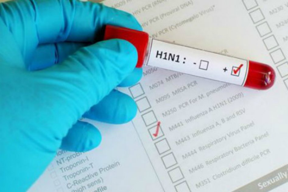En un mes en Panamá mueren 12 personas por gripe AH1N1
