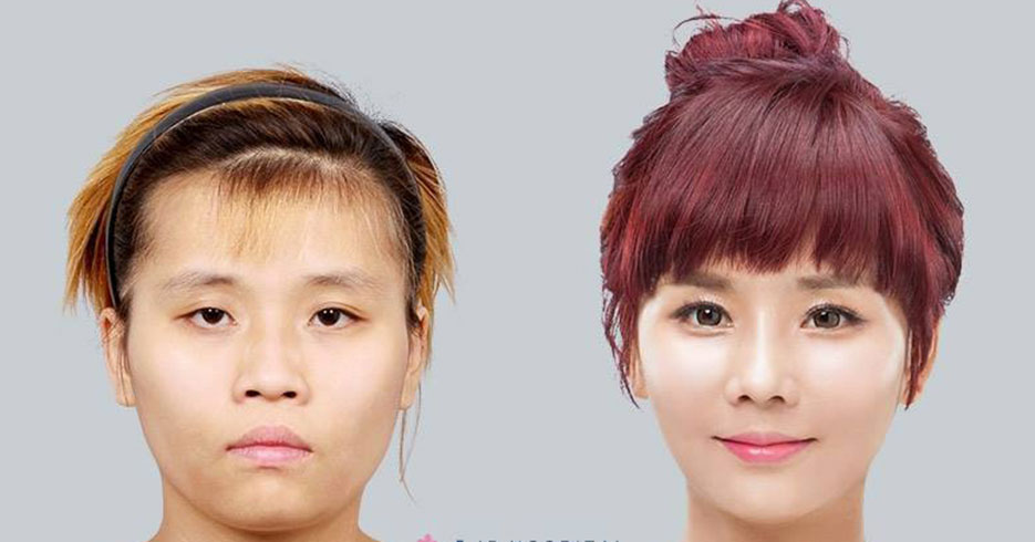 A punta de cirugías, reality transforma el rostro de una joven
