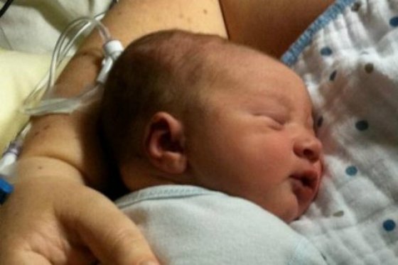 Infección congénita del zika puede provocar sordera en los niños