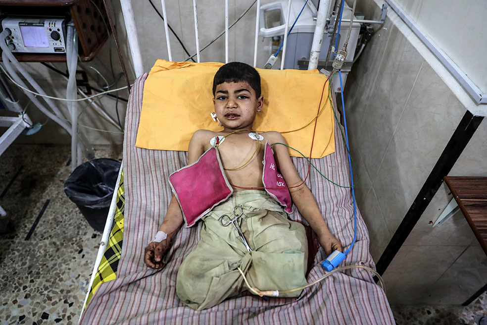 Los niños, las principales víctimas de los últimos bombardeos de la guerra en Siria
