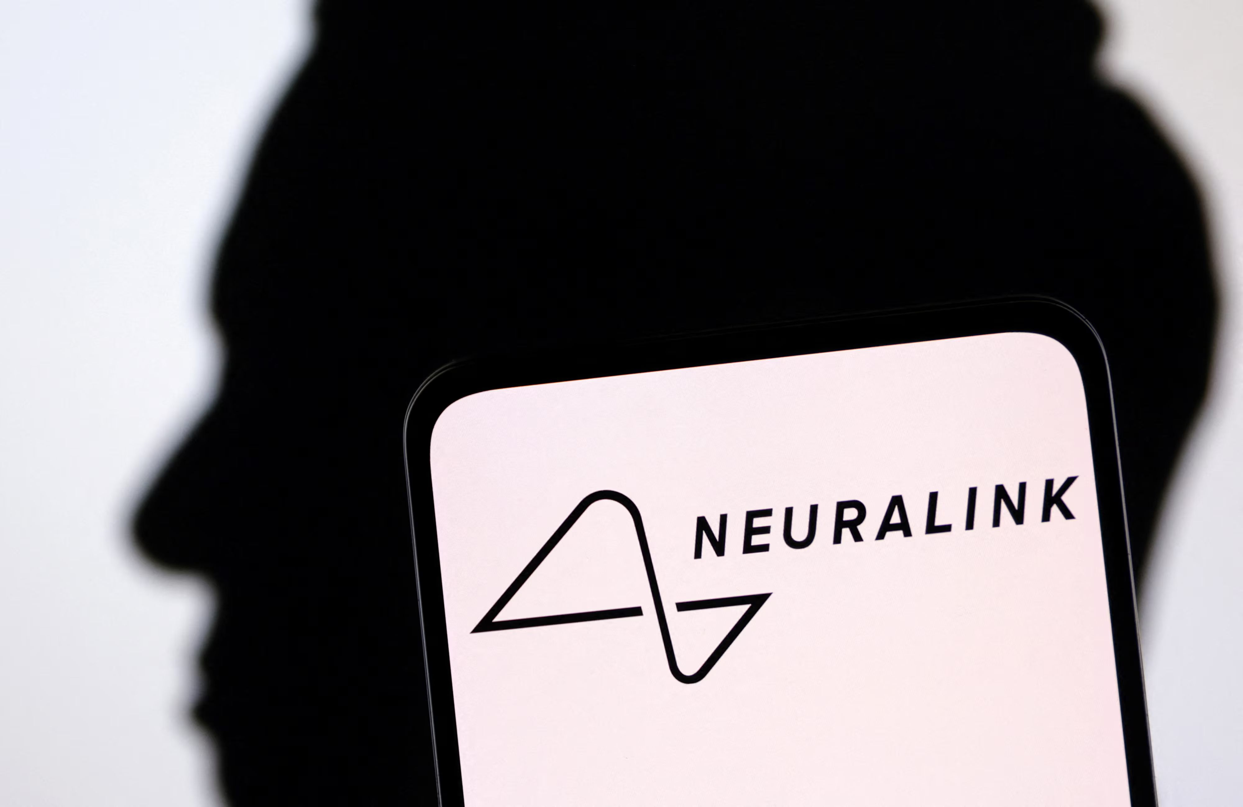 Este es el implante de Neuralink que permite jugar videojuegos solo con la mente