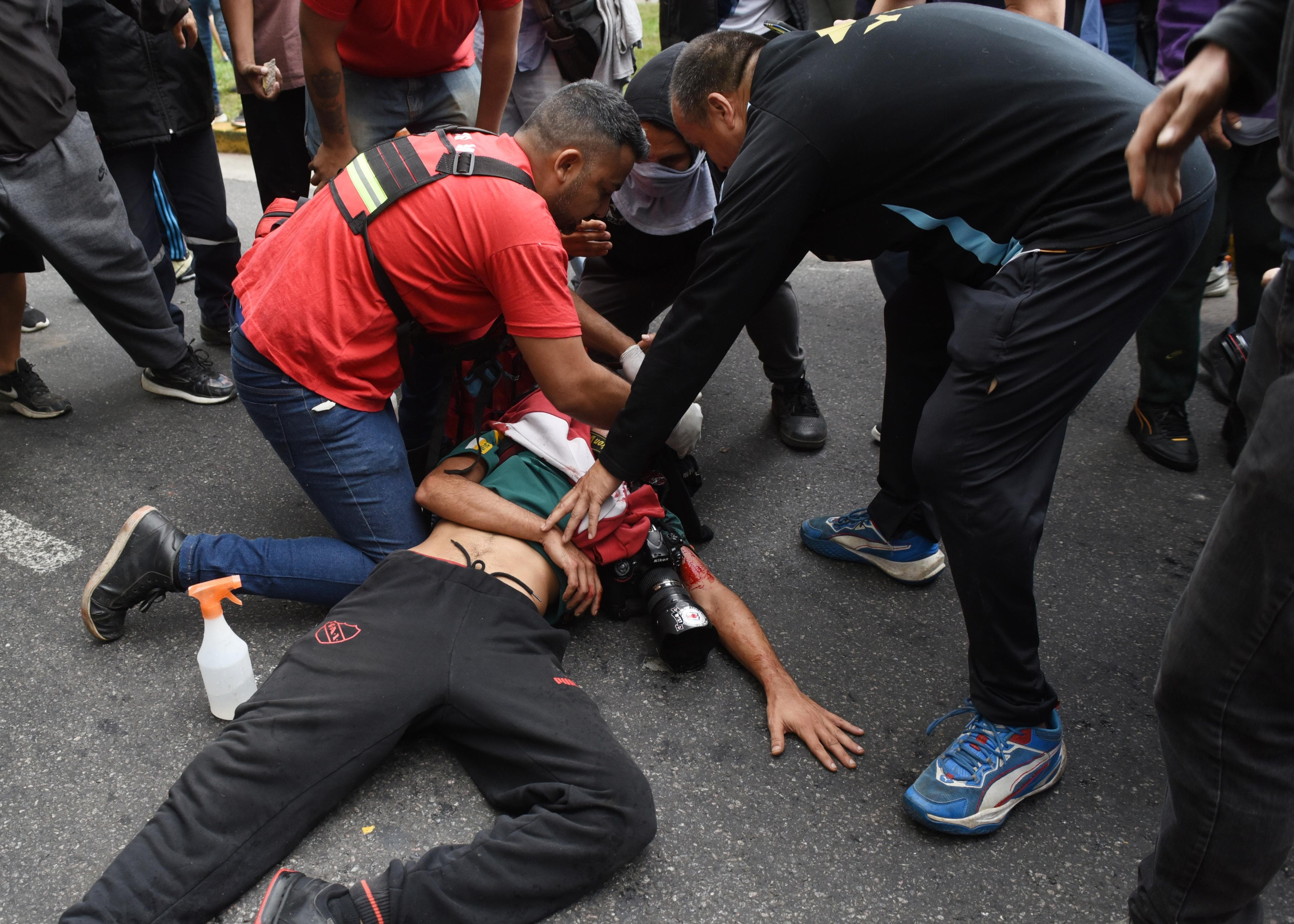 Periodista argentino en estado crítico tras ser herido por la policía en protesta