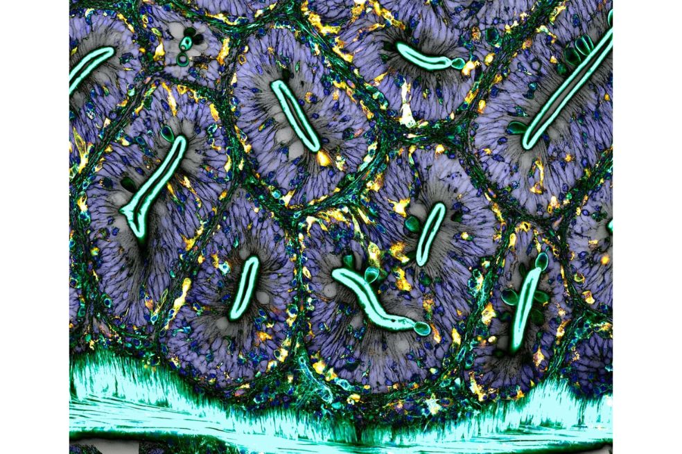 Red de macrófagos (glóbulos blancos) del intestino de un pez cebra adulto
