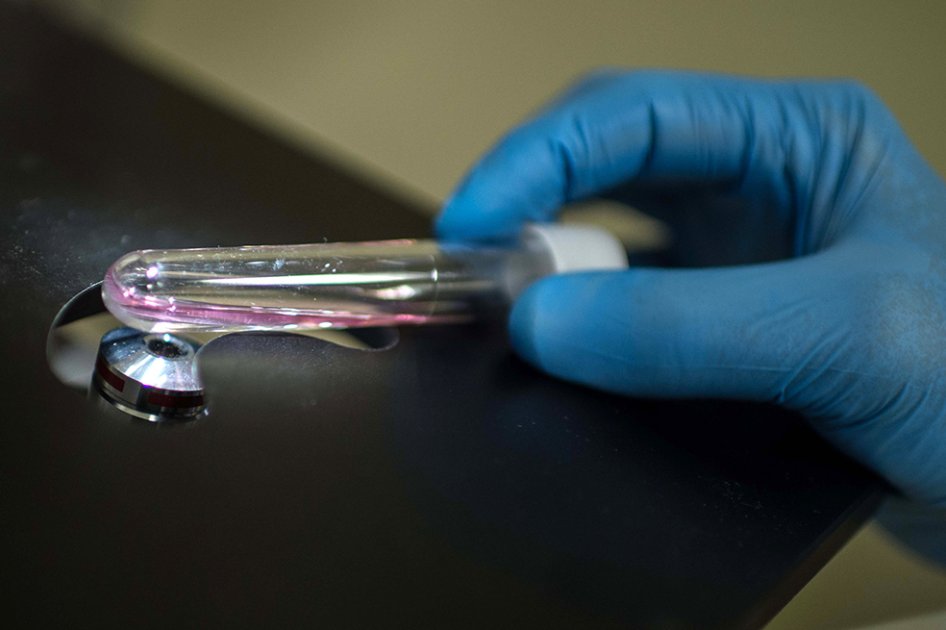 Grandes farmacéuticas, en la carrera por encontrar vacuna contra el zika
