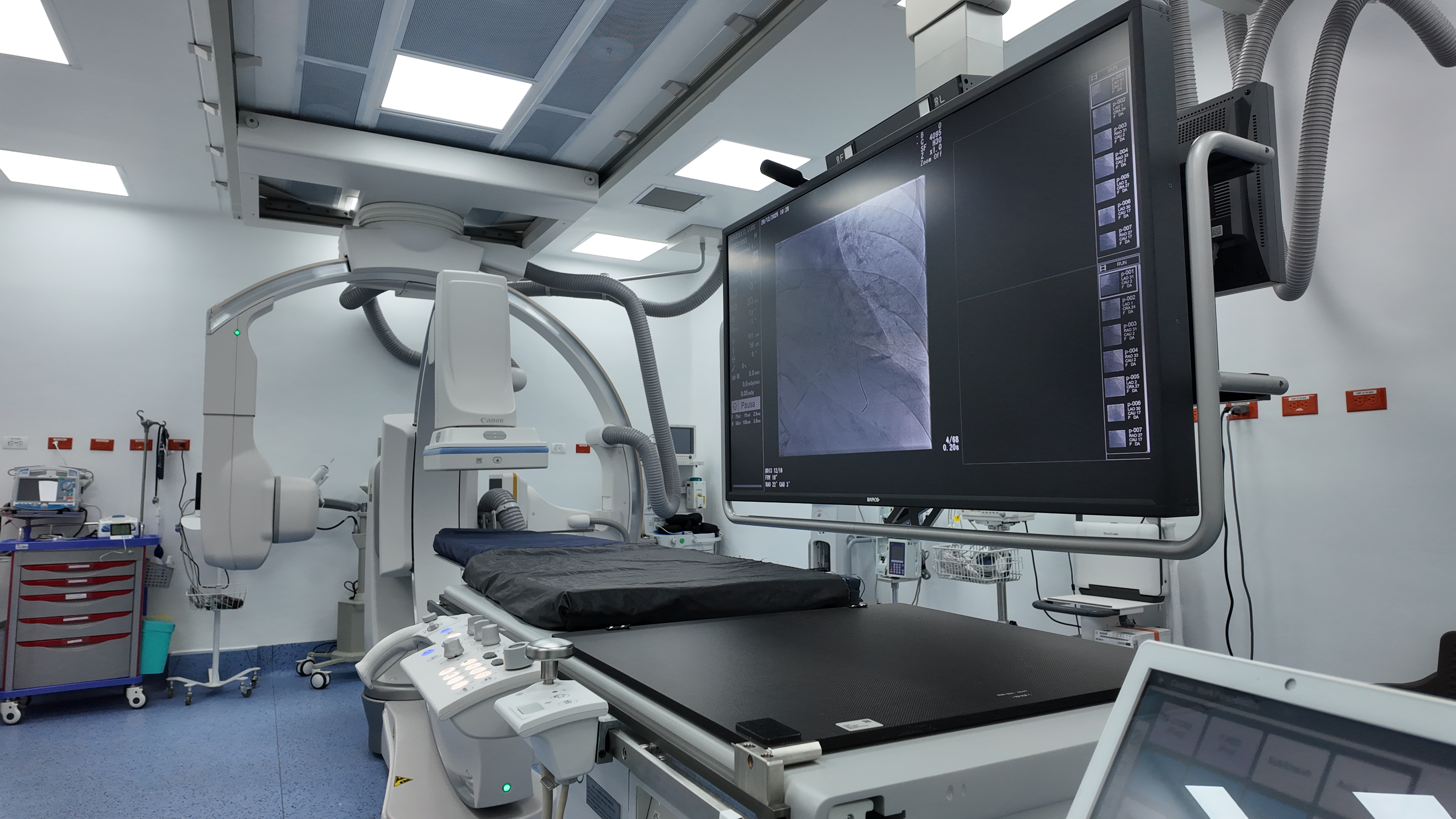 Primer angiógrafo de alta tecnología para la salud pública capitalina.