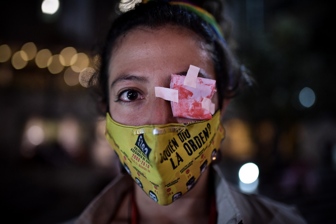 Otros jóvenes en el pasado también sufrieron heridas semejantes, incluso, cuando no eran partícipes de movilizaciones.