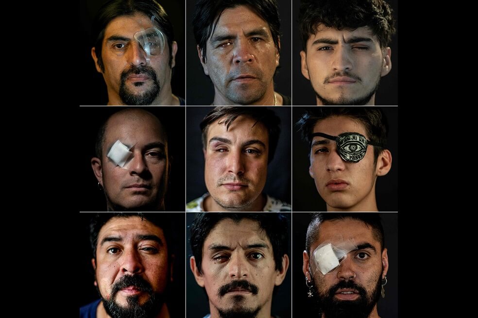 «Los ojos de Chile»: La iniciativa que busca ayudar a los lesionados en las protestas