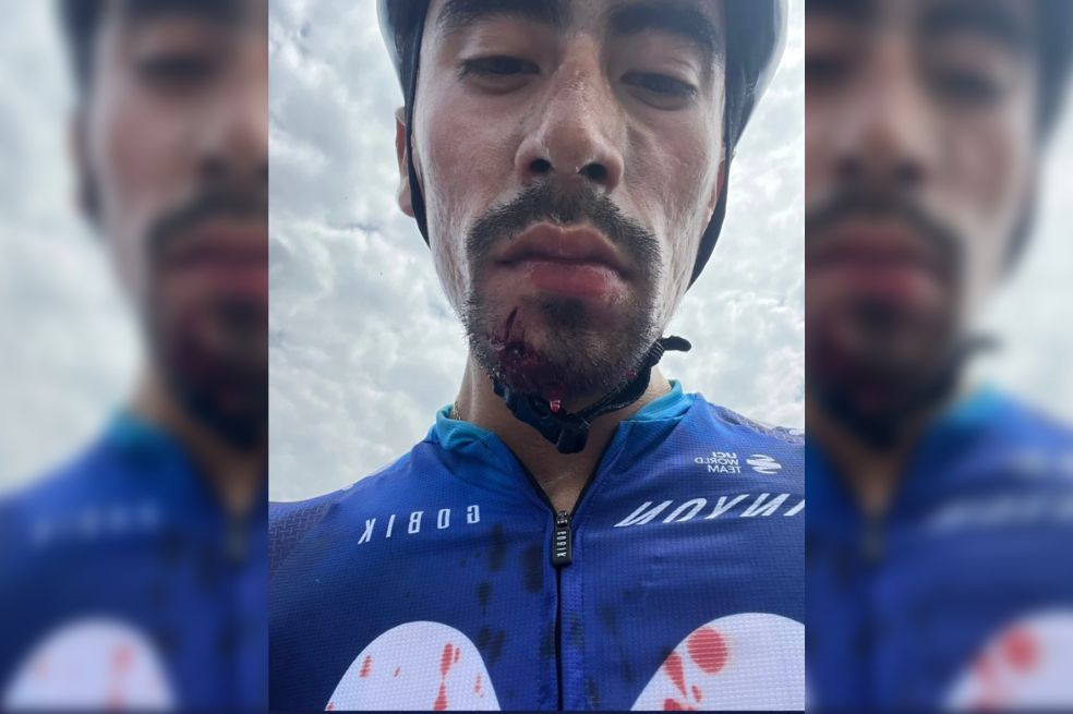 Así quedó el rostro de Iván Ramiro Sosa.
