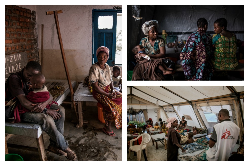 Las impresionantes imágenes de la epidemia de cólera en Kivu Sur