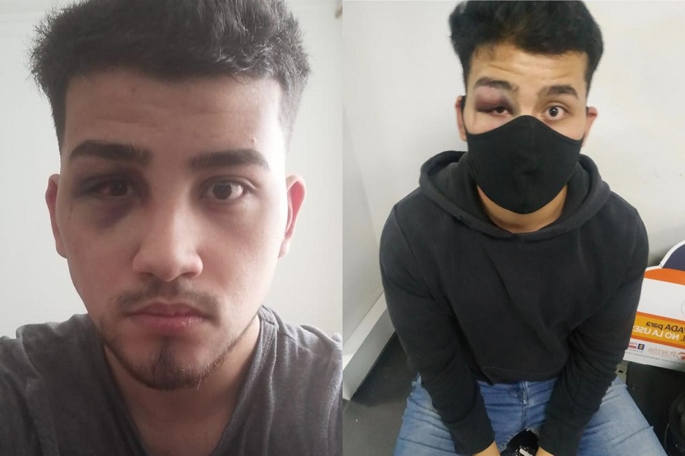 Diego, el estudiante de periodismo que recibió golpiza por parte de policías en Fontibón