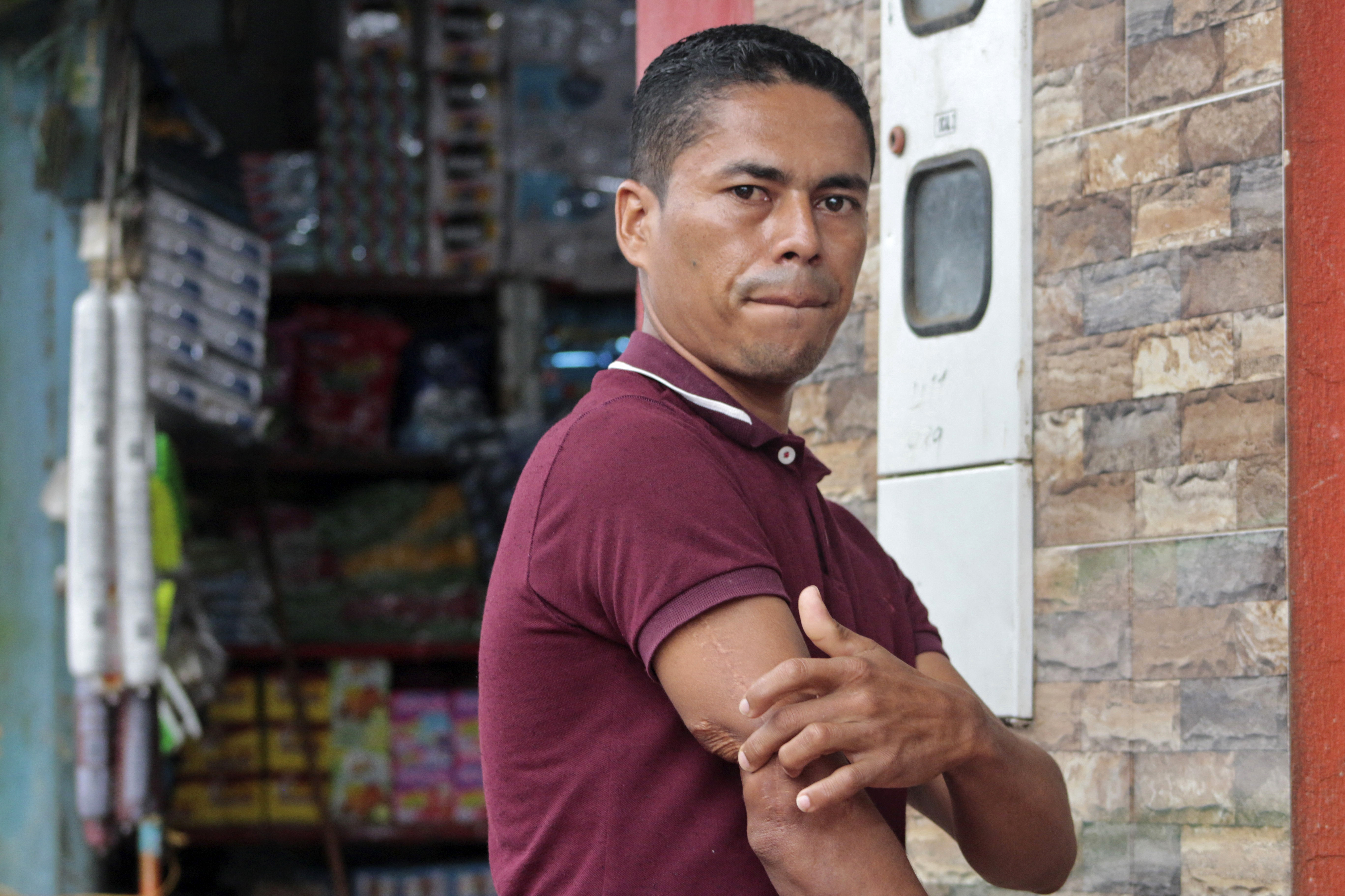 Falsos positivos: la historia del sobreviviente que fingió su muerte