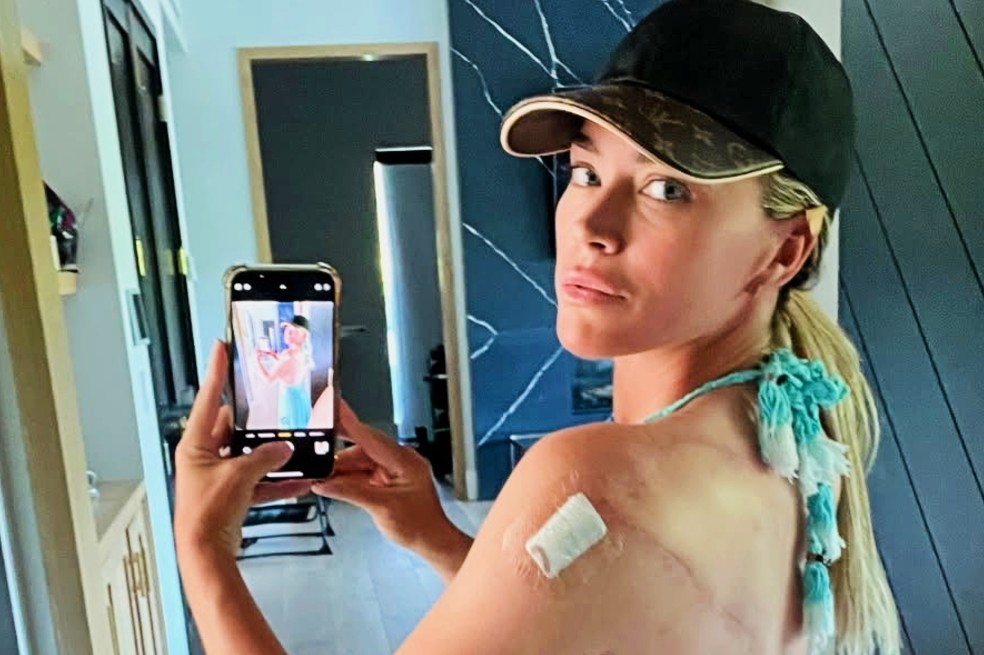 Teddi Mellencamp da nuevo reporte sobre su salud: “me han operado varias veces”