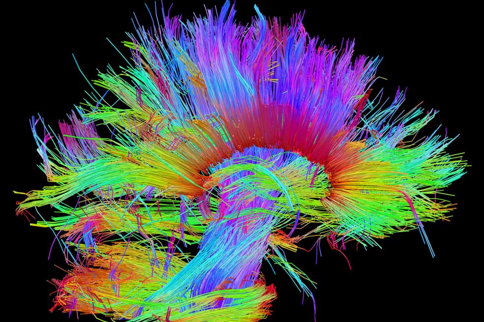 La costosa idea de mapear el cerebro