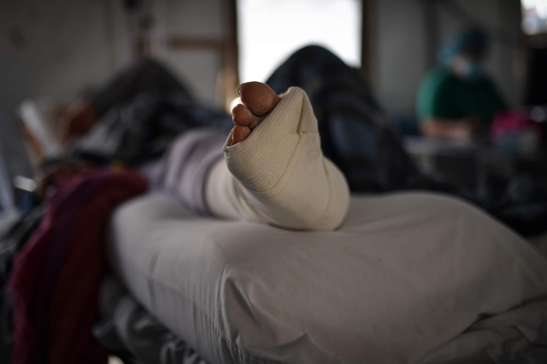 El pie de un hombre con un yeso en la pierna