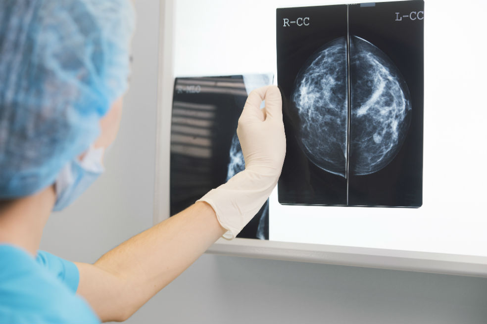 Las mujeres con tejido mamario denso corren mayor riesgo de cáncer de mama